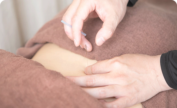 施術を受けている様子